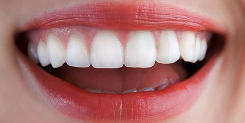 طراحی لبخند دیجیتال