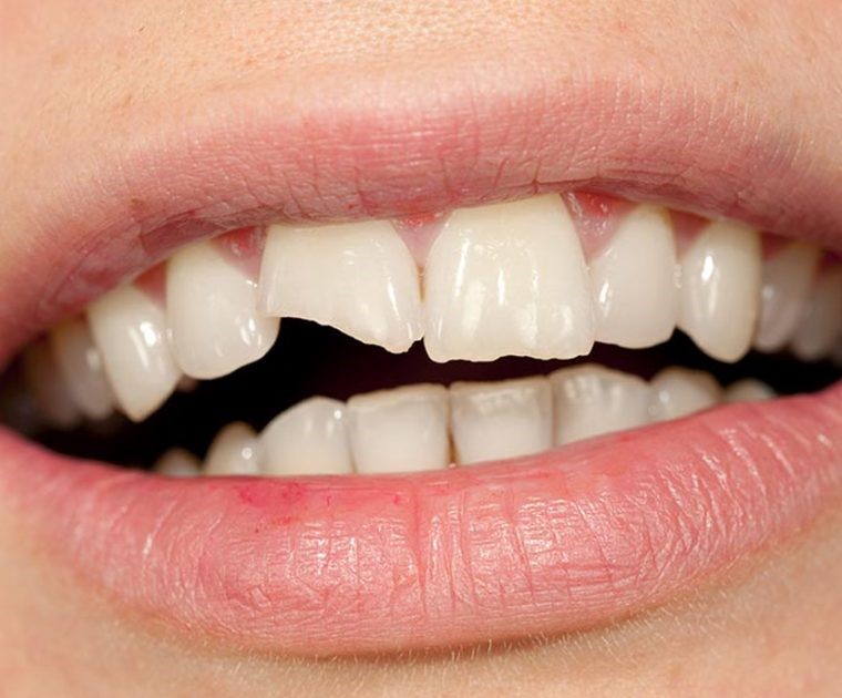 طراحی لبخند دیجیتال