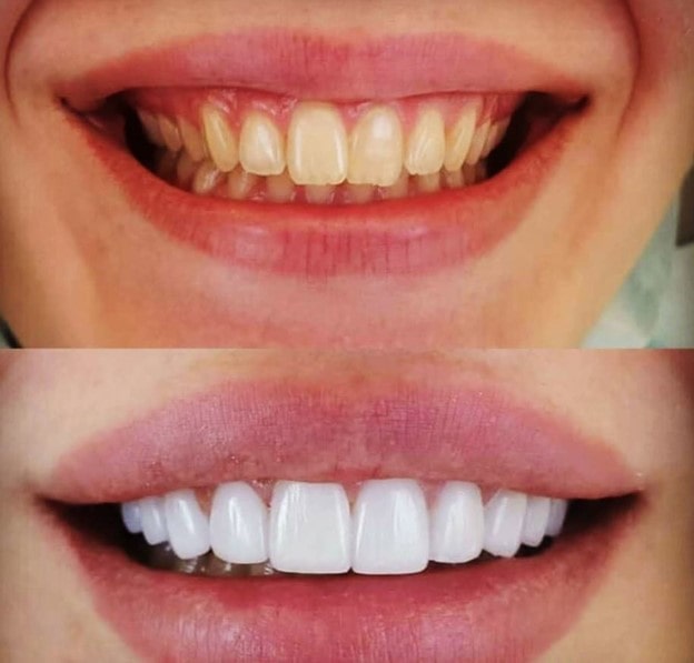 کامپوزیت چیست و چه کاربردی دارد؟